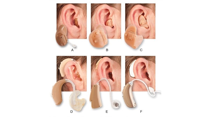 قیمت سمعک فراهوشمند