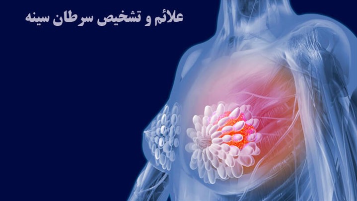 چگونه به موقع سرطان سینه را تشخیص دهیم؟ علائم سرطان سینه و روش های تشخیص آن چگونه به موقع سرطان سینه را تشخیص دهیم؟ علائم سرطان سینه و روش های تشخیص آن
