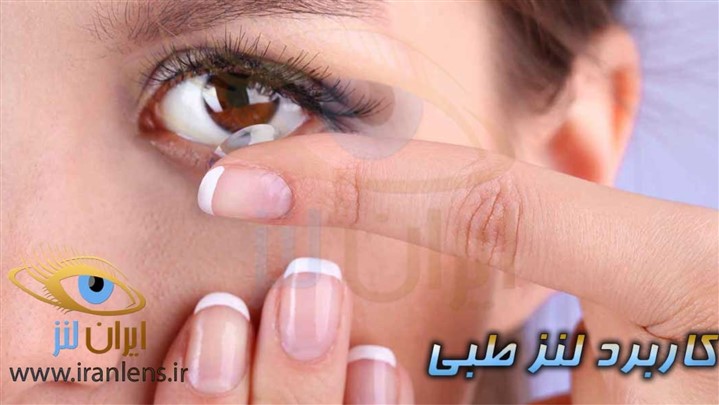 ایران لنز، انتخاب آگاهانه لنز ایران لنز، انتخاب آگاهانه لنز