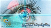 ایران لنز، انتخاب آگاهانه لنز ایران لنز، انتخاب آگاهانه لنز