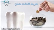 هزینه ایمپلنت دندان کلینیک دکترآقاجری