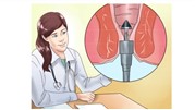 چطور بهترین متخصص بواسیر را انتخاب کنیم؟