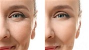 حقایقی جالب درباره جراحی تزریق چربی
