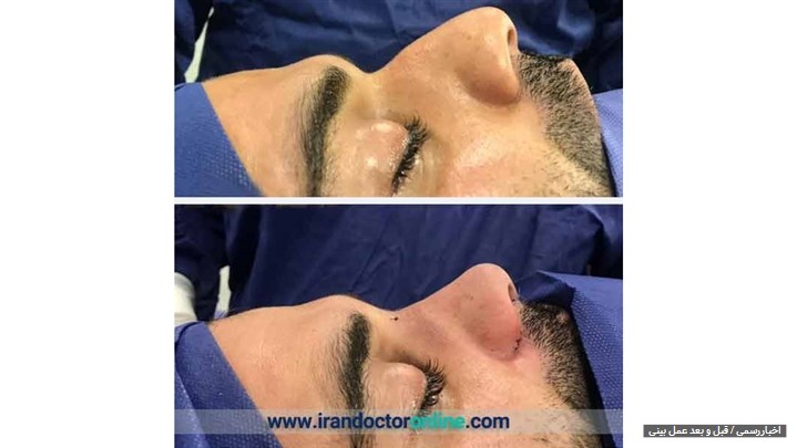 رزرو عمل های زیبایی با ایران دکتر آنلاین 