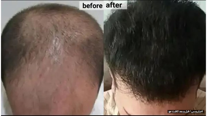 بهترین جراح عمل بینی و رزرو سریع نوبت با ایران دکتر آنلاین بهترین جراح عمل بینی و رزرو سریع نوبت با ایران دکتر آنلاین