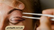 تفاوت بلفاروپلاستی با دیگر عمل های چشم