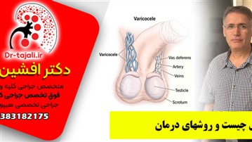دکتر تجلی بهترین جراح واریکوسل در ایران