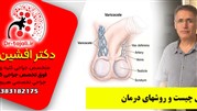 دکتر تجلی بهترین جراح واریکوسل در ایران