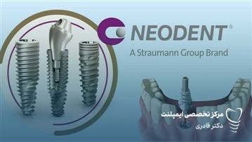 ایمپلنت نئودنت؛ راهکاری مطمئن برای جایگزینی دندان‌های از دست‌رفته