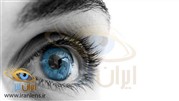 خرید لنزهای رنگی چشمی از سایت ایران لنز
