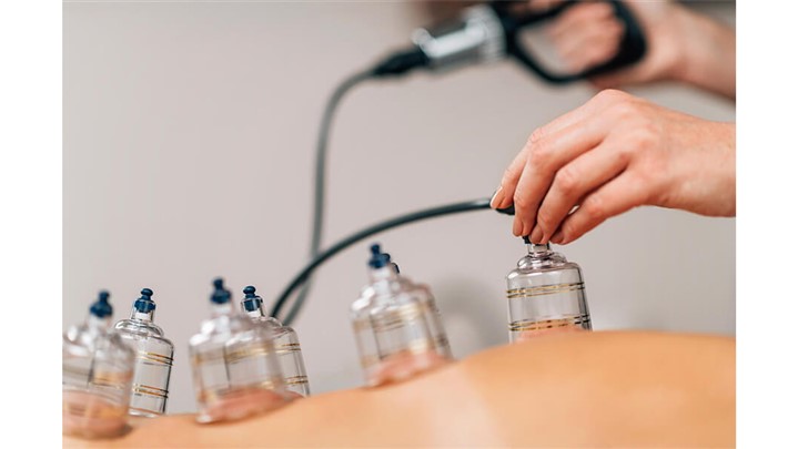 ایا حجامت برای درد سیاتیک خوب است؟