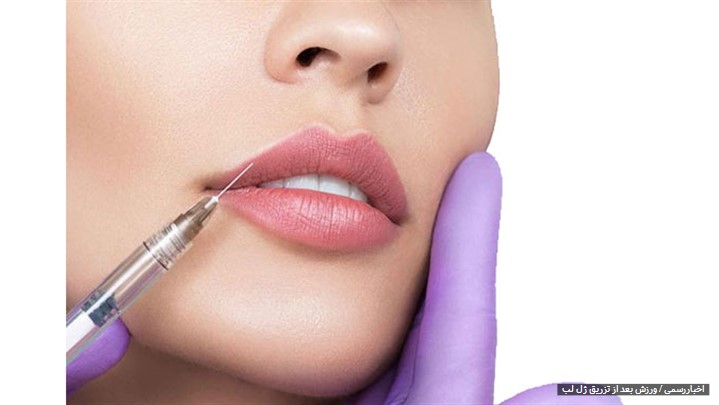 ورزش بعد از تزریق ژل ورزش بعد از تزریق ژل