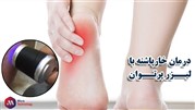 درمان خارپاشنه با لیزر پرتوان در فیزیوتراپی