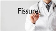 درمان شقاق مقعدی توسط پزشک متخصص