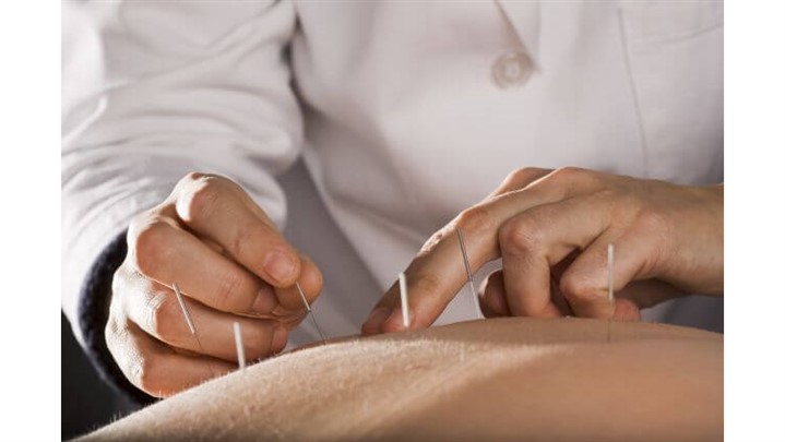 آغاز ارائه خدمات طب سوزنی در کلینیک آرامش توسط دکتر امیر هومن کاظمی آغاز ارائه خدمات طب سوزنی در کلینیک آرامش توسط دکتر امیر هومن کاظمی