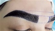 کاشت ابرو یک روش محبوب برای بهبود ظاهر صورت