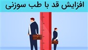اثر طب سوزنی در افزایش قد