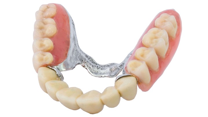 دندان مصنوعی، بهترین راه برای جبران بی دندانی!