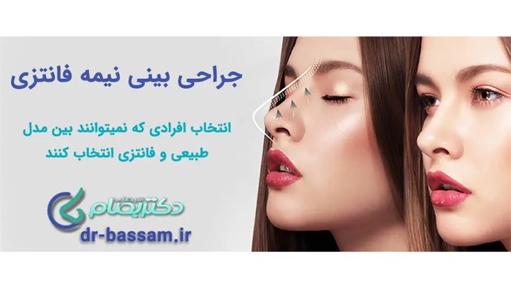 جراحی بینی نیمه فانتزی جراحی بینی نیمه فانتزی
