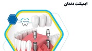 چرا انجام ایمپلنت دندان را انتخاب کنیم؟