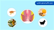 درمان خانگی فیستول مقعدی کاهش علائم و پیشگیری از تشدید بیماری