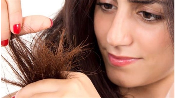 چگونه از موخوره شدید جلوگیری کنیم؟