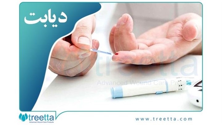 دیابت چیست؟ پیش دیابت، علائم، زخم پای دیابتی/ نشانه ها و انواع آن 2022 دیابت چیست؟ پیش دیابت، علائم، زخم پای دیابتی/ نشانه ها و انواع آن 2022