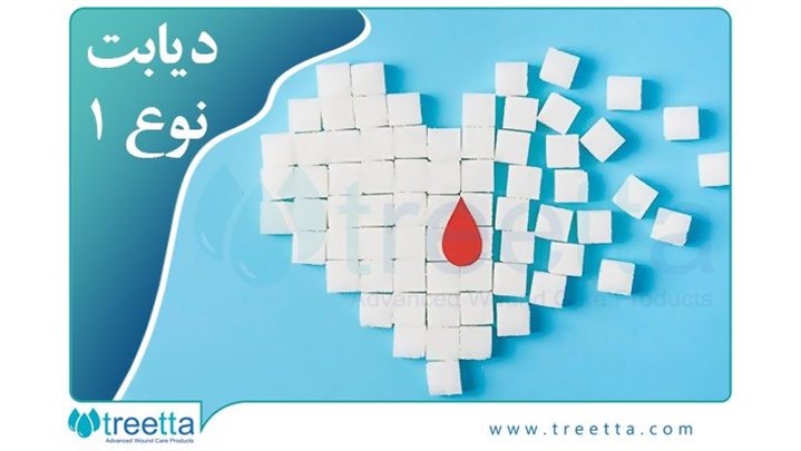 دیابت چیست؟ پیش دیابت، علائم، زخم پای دیابتی/ نشانه ها و انواع آن 2022 دیابت چیست؟ پیش دیابت، علائم، زخم پای دیابتی/ نشانه ها و انواع آن 2022