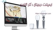 ایمپلنت دیجیتال دکتر آقاجری؛ روش‌های نوین کاشت دندان
