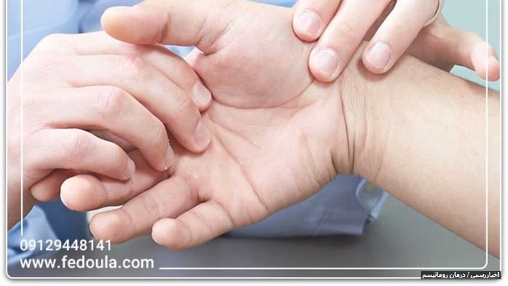 آیا روماتیسم درمان قطعی دارد؟ | فدولا آیا روماتیسم درمان قطعی دارد؟ | فدولا