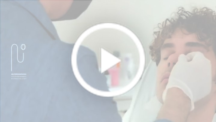 ریمادلینگ و زاویه سازی صورت