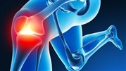 چگونه بهترین جراح ارتوپد را برای عمل تعویض مفصل زانو انتخاب کنیم