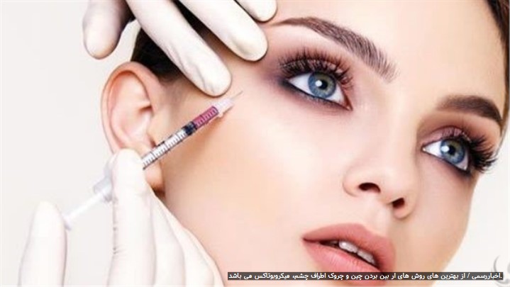 میکروبوتاکس چگونه کار میکند؟ میکروبوتاکس چگونه کار میکند؟