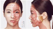 میکروبوتاکس چگونه کار میکند؟ میکروبوتاکس چگونه کار میکند؟