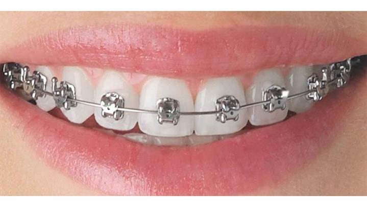 انواع مشکلات دندان و راه درمان