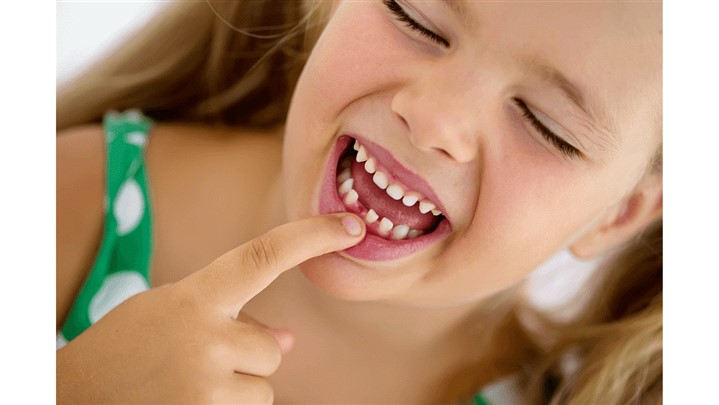 انواع مشکلات دندان و راه درمان