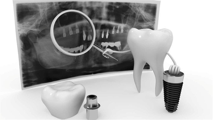 تحول در دندانسازی دیجیتال با تجهیزات لابراتواری دنتکم