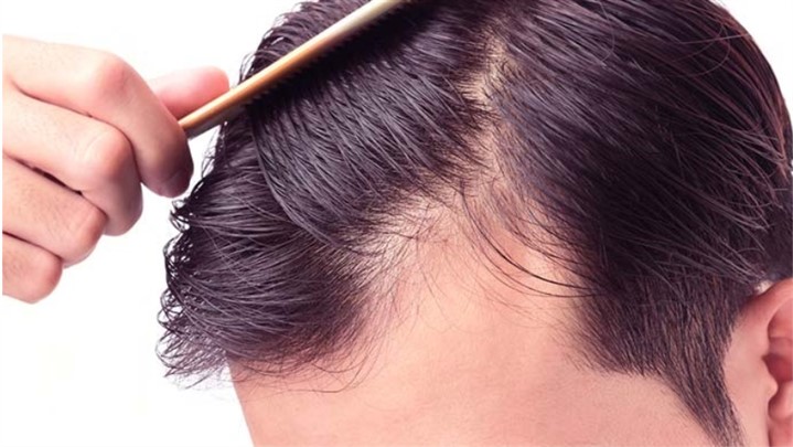 معرفی برترین روش های جدید برای داشتن موهای نرم معرفی برترین روش های جدید برای داشتن موهای نرم