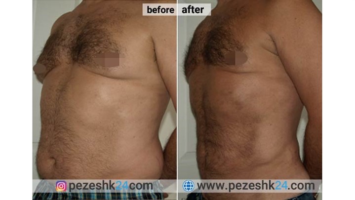 رزرو سریع نوبت عمل بینی (و سایر عمل‌های زیبایی) با پزشک 24