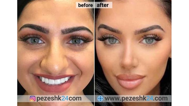 رزرو سریع نوبت عمل بینی (و سایر عمل‌های زیبایی) با پزشک 24