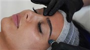 کاشت ابرو + مزوتراپی؛ تکمیل زیبایی دائمی ابروهایتان