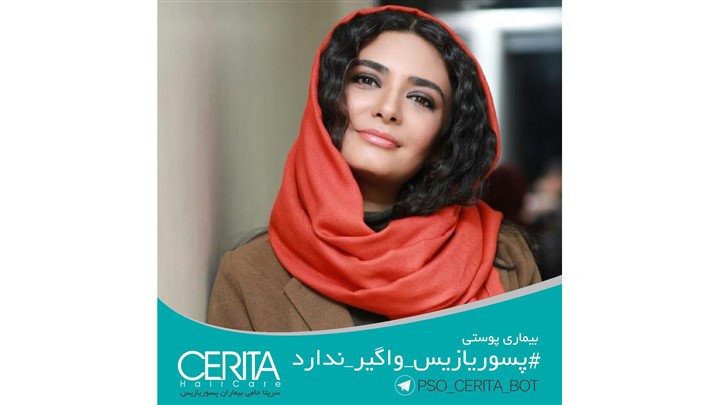 حضور یکتا ناصر و لیندا کیانی در همایش ملی پسوریازیس سریتا حضور یکتا ناصر و لیندا کیانی در همایش ملی پسوریازیس سریتا