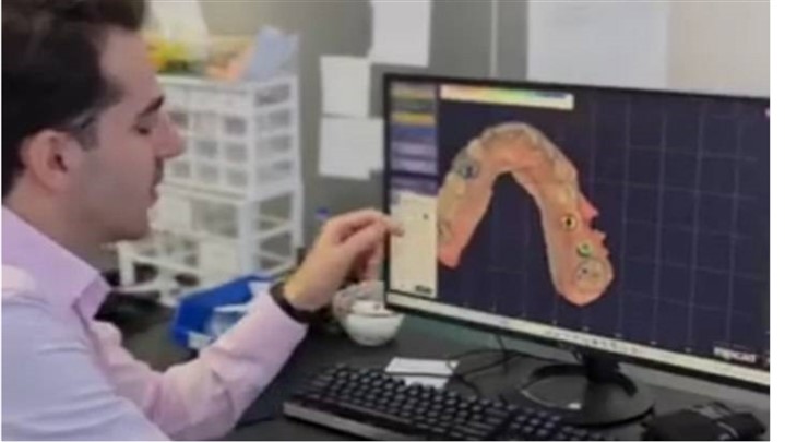 ایمپلنت دیجیتال تهران چقدر هزینه دارد؟