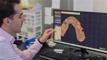 ایمپلنت دیجیتال تهران چقدر هزینه دارد؟