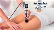 تاثیر شاک ویو در درمان سلولیت