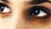 درمان سیاهی دور چشم با لیزر