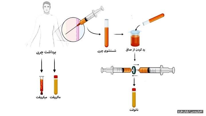 «بایوفت» شیوۀ نوین و سرآمد تزریق چربی