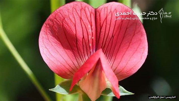 آیا لابیاپلاستی باعث افزایش اعتماد به نفس می شود؟