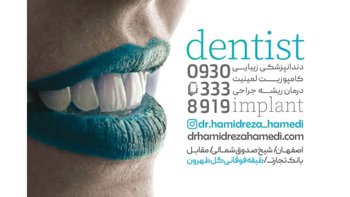 مراحل کاشت ایمپلنت دندان