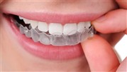 ارتودنسی نامرئی با الاینرهای شفاف